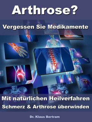 cover image of Arthrose? – Vergessen Sie Medikamente – Mit natürlichen Heilverfahren Schmerz & Arthrose überwinden
